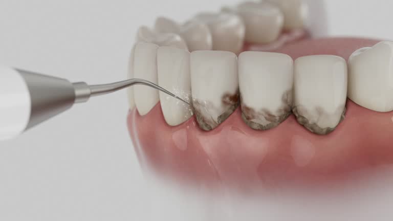Reliable Invisalign Clear Aligners contractor in Paulina, LA by Smile Center Dentistry